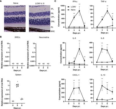 Systemic virus infection results in CD8 T cell recruitment to the retina in the absence of local virus infection